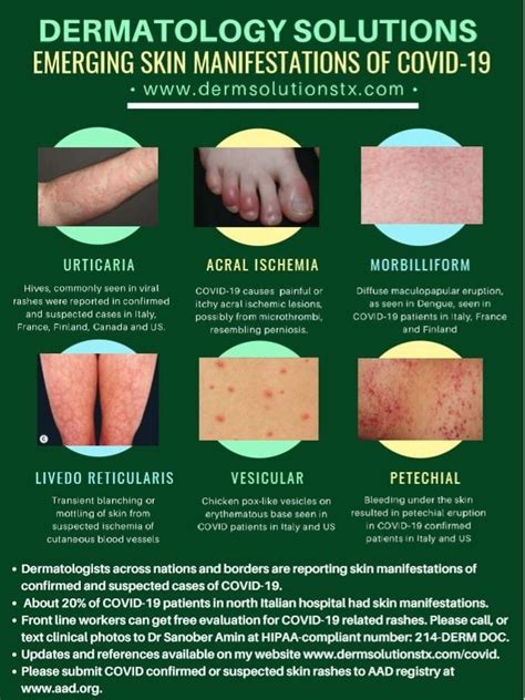 Emerging Skin Manifestations Of Covid 19 Dawes Fretzin Dermatology Group