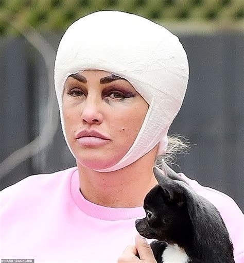 katie price sports two black eyes and wears a full head bandage after having an eye and brow