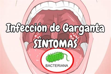 Síntomas De Infección En La Garganta Por Virus【tipos De Infecciones】