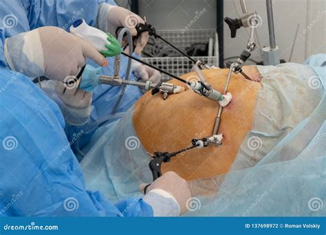 Endoscopy Laparoscopy The Hands Of Doctors Using Laparoscopic