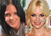 Anna Faris Plastic Surgery REVEALED (Before & After 2021)