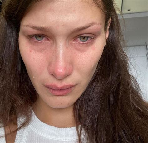 bella hadid opens up about her mental health blacgoss
