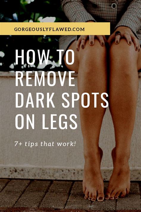 How To Remove Dark Spots On Legs With Images Dark Spots On Legs