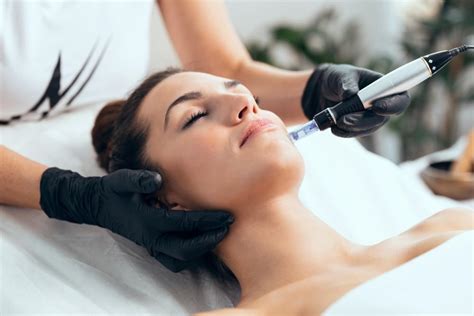 here s what to expect in the days after your microneedling treatment jordan valley dermatology