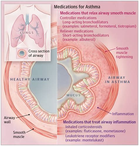 How Do Asthma Drugs Work