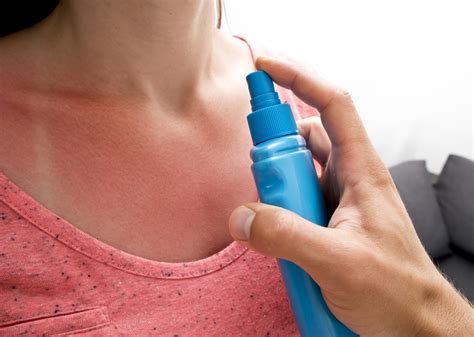 Sunburn Symptoms And Recommendations Redness Pain Swelling And
