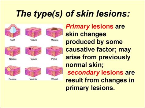 Identifying Skin Lesions