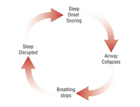 Snoring And Obstructive Sleep Apnea Sydney Holistic Dental Centre