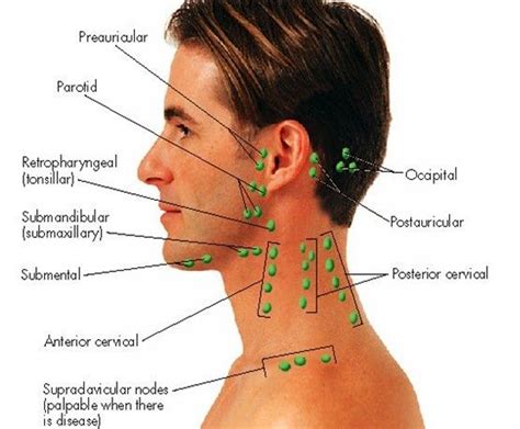 This article describes the anatomy of the head and neck of the human body, including the brain, bones, muscles, blood vessels, nerves, glands, nose, mouth, teeth, tongue, and throat. lymph glands in the head - Google Search | Physician ...