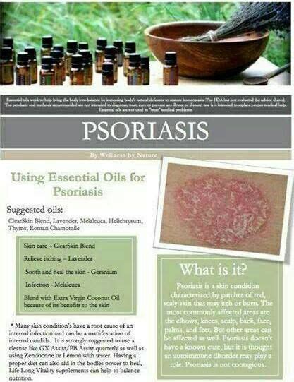 Essential Oils For Psoriasis Psoriasis Psoriasis Image
