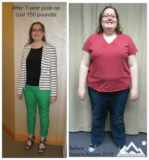 Jessica Lost Over 150 Lbs After Gastric Bypass Surgery