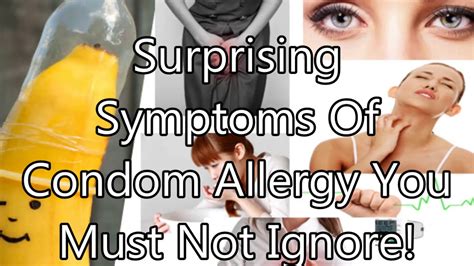 Surprising Symptoms Of Condom Allergy You Must Not Ignore Health Tips Youtube