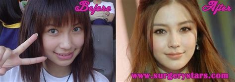 Angelababy Plastic Surgery Before After Breast Implants Hot Sex Picture