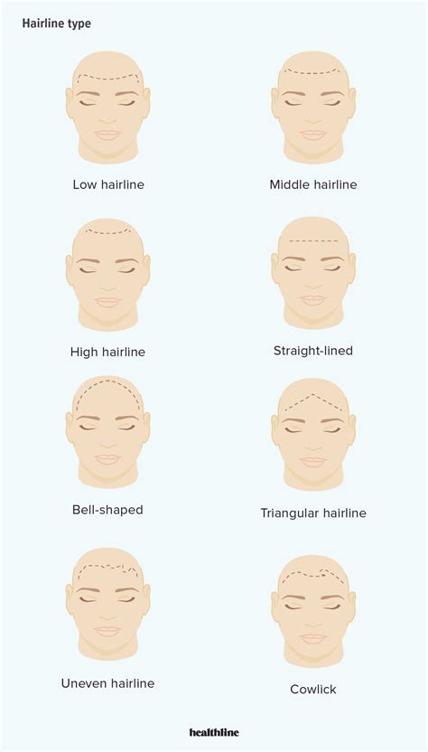 Normal Hairline How It Looks Compared To Receding Hairstyles For Receding Hairline Hairline