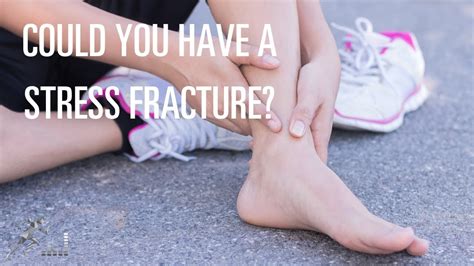 Navicular Stress Fracture Signs Symptoms And Treatment Options Youtube