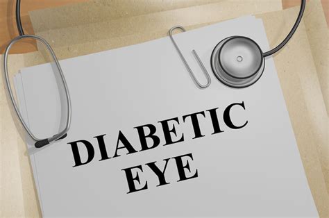 Ophthalmology 360 Updated Guidelines For Diabetic Eye Care