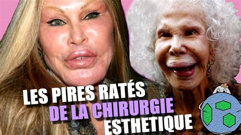 LES PIRES RATÉS DE LA CHIRURGIE ESTHÉTIQUE YouTube