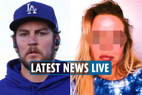 Trevor Bauer Text Messages News Dodgers Pitcher Left Victim With Two Black Eyes She Told