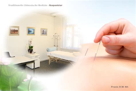 Wie Wirkt Akupunktur Durch Tcm Art Chinesische Medizin Akupunktur Zürich Praxis Tcm Ma Drmed