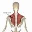The Trapezius Muscle Its Attachments And Actions  Yoganatomy