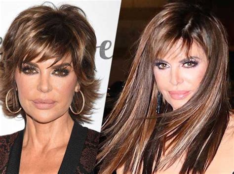 Lisa Rinna Plastic Surgery Botox Lip Fillers Photos After And Before