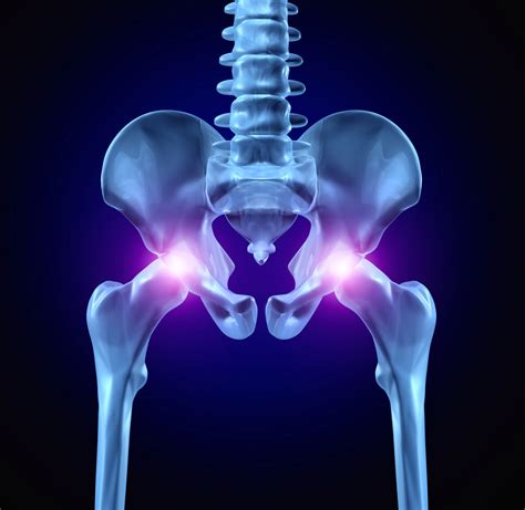What You Can Never Do After Hip Replacement Surgery