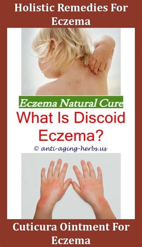 Difference Between Nummular Eczema And Ringwormeczema Rash Treatment