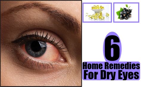 6 Home Remedies For Dry Eyes Natural Home Remedies And Supplements