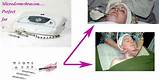 What Do Microdermabrasion Treatments Do Pictures