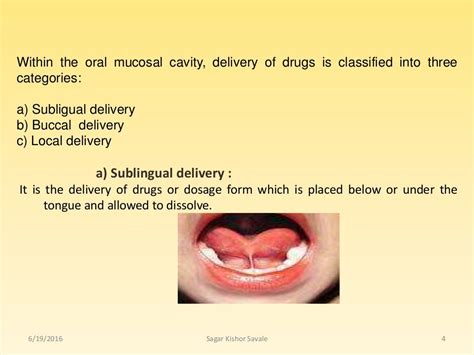 Buccal And Sublingual Drug Delivery System