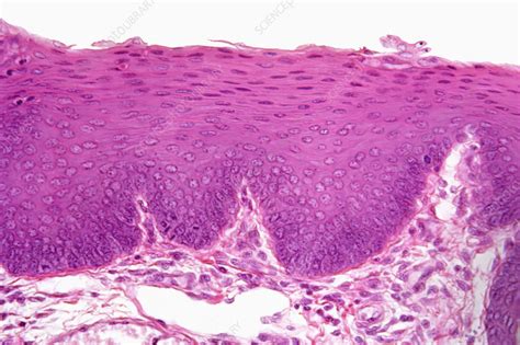 Stratified Squamous Epithelium Lm Stock Image C0055901 Science