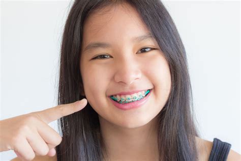 Oral Hygiene When You Are Wearing Braces