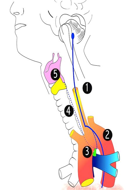 The Recurrent Laryngeal Nerves And The Thoracic Surgeon Ctsnet