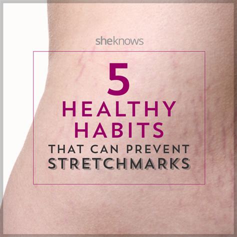 5 Ways To Battle Stretch Marks During Pregnancy Before They Start