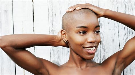 Share 73 Natural Hairstyles For Alopecia Latest In Eteachers