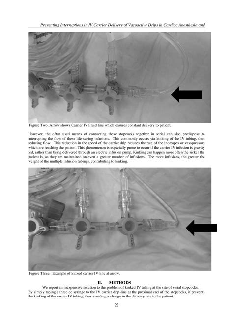 Preventing Interruptions In Iv Carrier Delivery Of Vasoactive Drips I