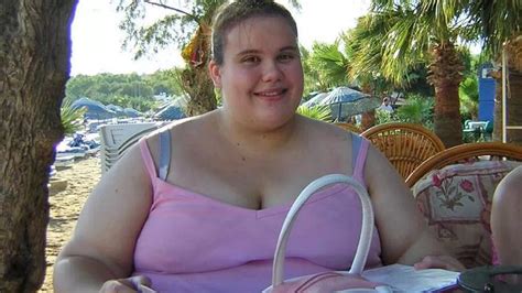 Obese Woman Developed Anorexia After Shedding Stone And Becoming