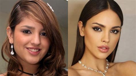 Thoughts About Plastic Surgery For Aesthetics R Askmiddleeast
