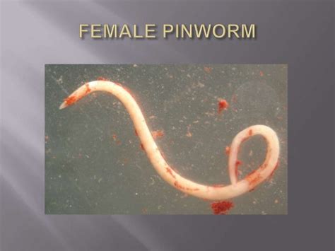 Enterobius Vermicularispinworm