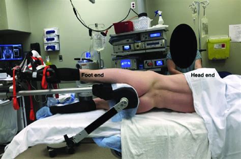 Positioning Of Left Hip For Hip Arthroscopy In Lateral Decubitus