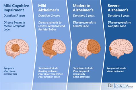 Stages Of Alzheimers Disease How The Disease Progresses Stage By Stage