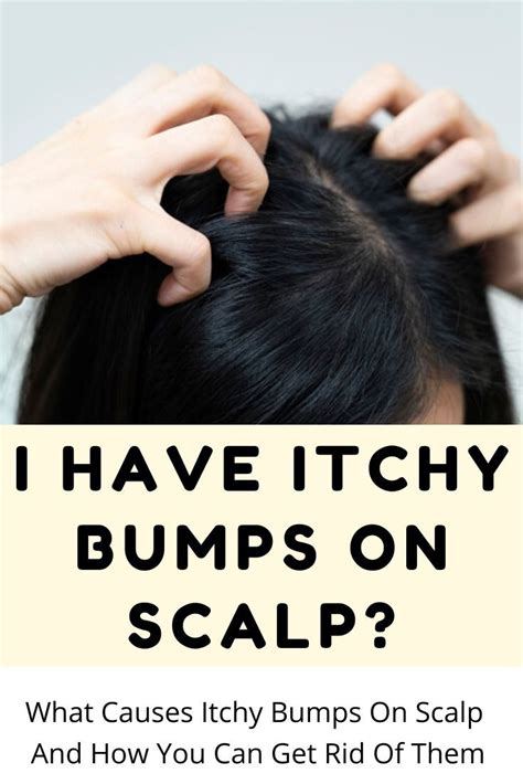 What Causes Itchy Bumps On Scalp And How You Can Get Rid Of Them In