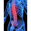 Low Back Pain – Endurance Chiropractic