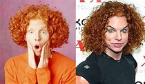 Carrot Top Plastic Surgery Before And After