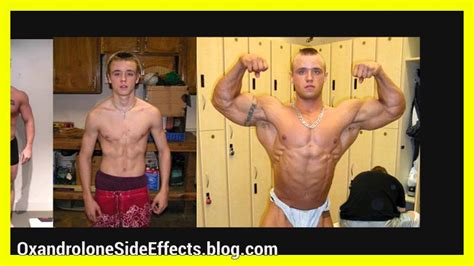Testosterone Before And After Pictures Youtube