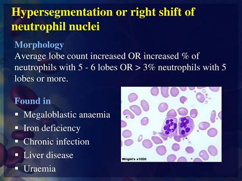 Ppt Wbcs And Plt Abnormal Morphology Powerpoint Presentation Free