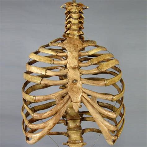 Rib cage pain on both sides may be sharp, dull, or achy and felt at or below the chest or above the navel on either side. "Harvey" Skeleton Rib Cage & Spine, Life Size, 2nd Class, Aged Version - Engineered Fear