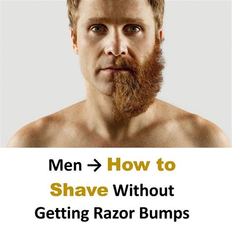 men how to shave without getting razor burn or bumps