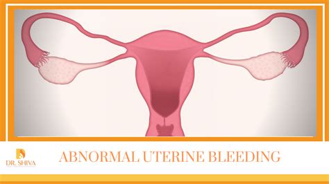 Abnormal Uterine Bleeding Symptoms Causes And Treatment Dr Shiva