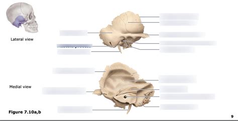 Lab The Temporal Bone Diagram Quizlet